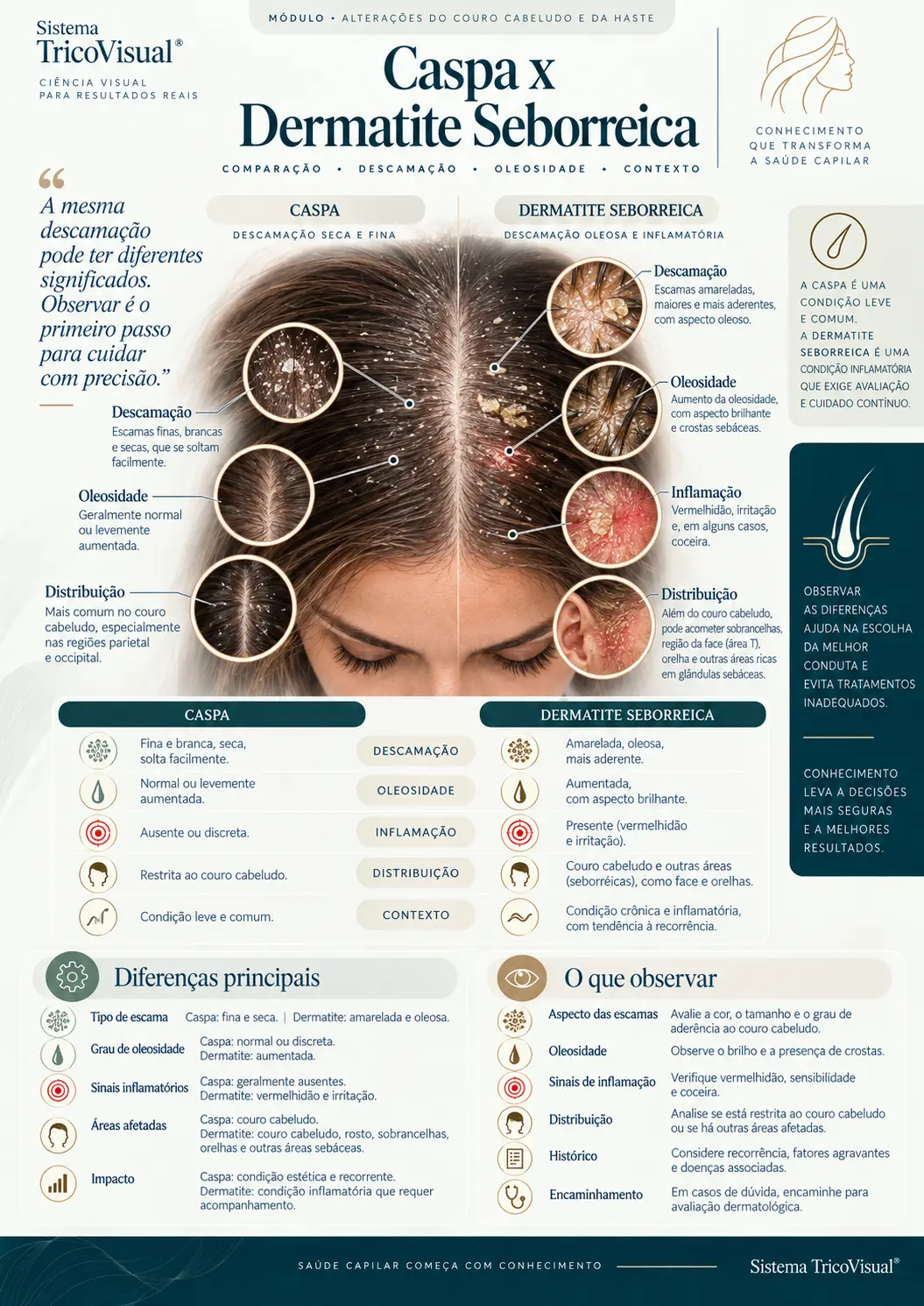 Ficha visual: Caspa x Dermatite Seborreica