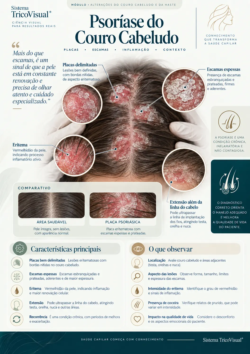 Ficha visual: Psoríase do Couro Cabeludo
