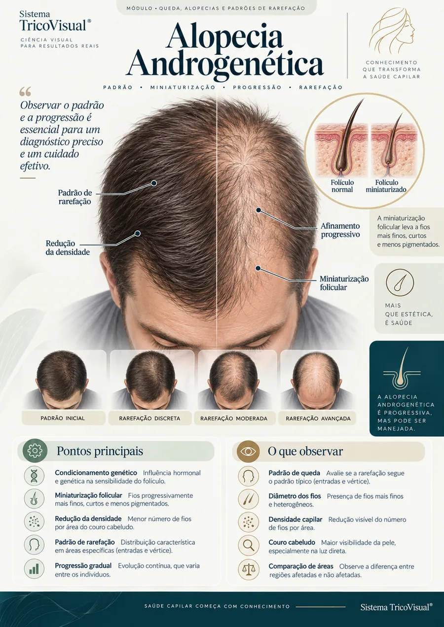 Alopecia Androgenética